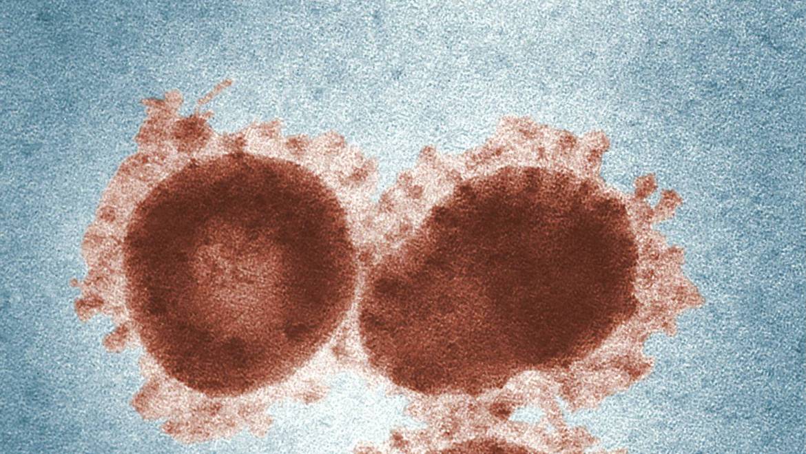 La inmunidad en Āyurveda: a propósito del coronavirus (COVID-19) y las enfermedades infecciosas